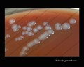 neisseria gonorrhoeae